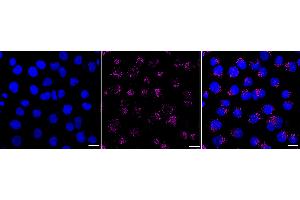 Immunocytochemical staining of HT- cells with Early endosome antigen 1 antibody (ABIN7798421), 1:1,000).
