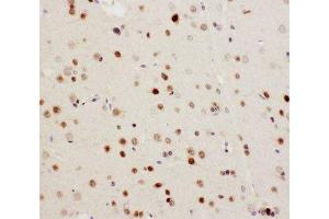 IHC-P: MEKK3 antibody testing of rat brain tissue