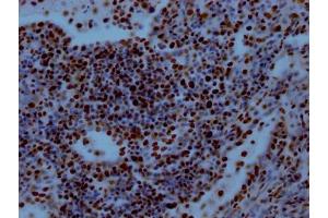 Immunohistochemistry (IHC) image for anti-Retinoblastoma Binding Protein 4 (RBBP4) antibody (ABIN7127789)