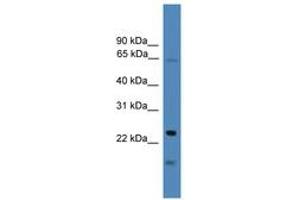 Image no. 1 for anti-TIMP Metallopeptidase Inhibitor 4 (TIMP4) (AA 101-150) antibody (ABIN6745268) (TIMP4 antibody  (AA 101-150))