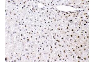 Immunohistochemistry (IHC) image for anti-High Mobility Group Box 1 (HMGB1) (AA 124-154) antibody (ABIN5647575)