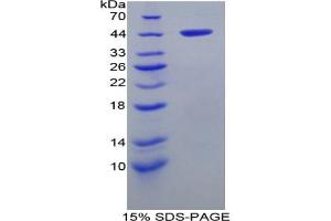 SDS-PAGE analysis of Rat aHSP Protein.