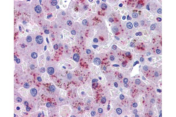 Hemopexin antibody  (AA 32-45)