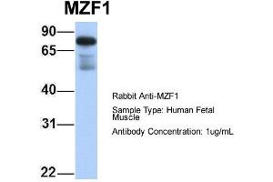 Host: Rabbit Target Name: MZF1 Sample Type: Human Fetal Muscle Antibody Dilution: 1. (MZF1 antibody  (N-Term))