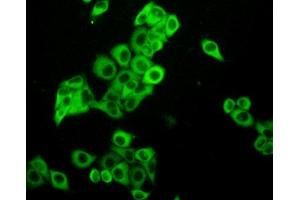 Figure:FITC staining on IHC-P Simple: Mcf7 cells (PKC iota antibody  (AA 375-596))