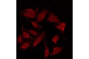 ABIN6275958 staining HuvEc by IF/ICC. (GPR151 antibody  (C-Term))