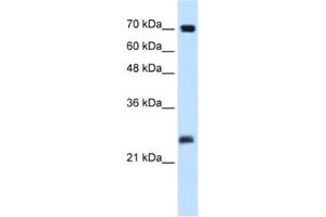 Western Blotting (WB) image for anti-SERTA Domain Containing 1 (SERTAD1) antibody (ABIN2460914)