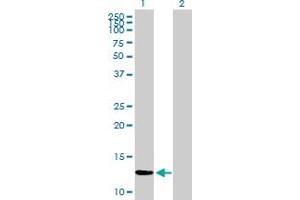 Western Blot analysis of ZNF343 expression in transfected 293T cell line by ZNF343 MaxPab polyclonal antibody. (ZNF343 antibody  (AA 1-118))