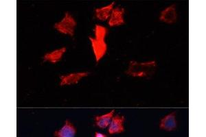 Immunofluorescence analysis of HeLa cells using CALM3 Polyclonal Antibody at dilution of 1:100.