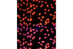 Immunofluorescence analysis of NIH-3T3 cells using ZNF581 Polyclonal Antibody (ABIN6128960, ABIN6150520, ABIN6150521 and ABIN6217055) at dilution of 1:100 (40x lens). (ZNF581 antibody  (AA 1-90))