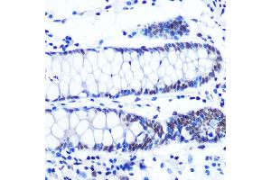 Immunohistochemistry (IHC) image for anti-Nuclear Respiratory Factor 1 (NRF1) antibody (ABIN7269022)