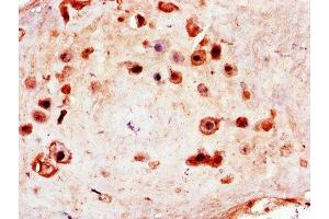 Immunohistochemistry of paraffin-embedded human placenta tissue using ABIN7150181 at dilution of 1:100