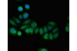 Immunofluorescent analysis of A549 cells using ABIN7146282 at dilution of 1:100 and Alexa Fluor 488-congugated AffiniPure Goat Anti-Rabbit IgG(H+L) (RCAN2 antibody  (AA 88-197))