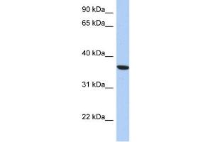 WB Suggested Anti-PSTK Antibody Titration: 0. (PSTK antibody  (Middle Region))