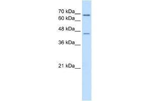 WB Suggested Anti-ALDH3A2 Antibody Titration:  0. (ALDH3A2 antibody  (C-Term))