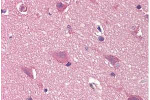 anti-Deoxycytidine Kinase (DCK) (N-Term) antibody