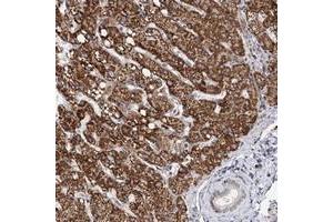 Immunohistochemical staining of human liver with ZCCHC24 polyclonal antibody  shows strong cytoplasmic positivity in hepatocytes while bile duct cells were negative at 1:200-1:500 dilution. (ZCCHC24 antibody)