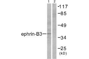 Western blot analysis of extracts from SKOV3 cells, using Ephrin-B3 antibody (ABIN5976389).