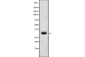 Western blot analysis of HoxD10 using K562 whole cell lysates