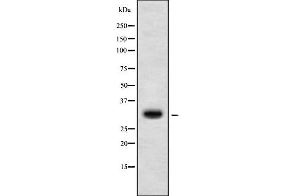 HOXD10 antibody  (Internal Region)