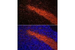 Immunofluorescence analysis of mouse brain using Myelin Basic Protein Rabbit mAb (ABIN7268431) at dilution of 1:100 (40x lens).