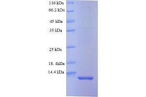 MYPR (AA 150-218) protein (His tag)