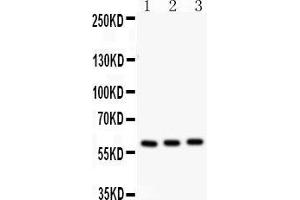 Anti-CYP11A1 antibody,  Western blotting All lanes: Anti CYP11A1 () at 0. (CYP11A1 antibody  (C-Term))