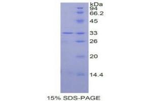 SDS-PAGE analysis of Human MAPK14 Protein. (MAPK14 Protein)