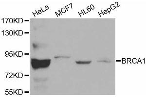 Western blot analysis of extracts of various cell lines, using BRCA1 antibody (ABIN5970045). (BRCA1 antibody)
