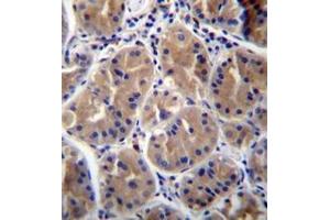 Formalin fixed and paraffin embedded human stomach tissue reacted with RAB27B Antibody  followed by peroxidase conjugation of the secondary antibody and DAB staining.