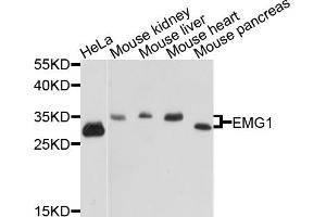 Western blot analysis of extracts of various cell lines, using EMG1 antibody (ABIN5972482) at 1/1000 dilution. (EMG1 antibody)