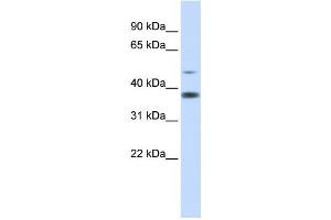 Western Blotting (WB) image for anti-Methylmalonic Aciduria (Cobalamin Deficiency) CblD Type, with Homocystinuria (MMADHC) antibody (ABIN2459880) (MMADHC antibody)