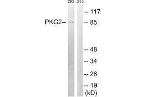 Western blot analysis of extracts from 293 cells, treated with anisomycin (25 μg/mL, 30 mins), using PKG2 (Ab-126) antibody. (PRKG2 antibody  (Ser126))