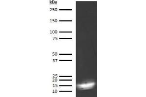 Western Blotting (WB) image for anti-Synuclein, gamma (Breast Cancer-Specific Protein 1) (SNCG) antibody (ABIN613803) (SNCG antibody)