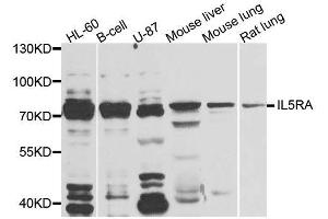 Western blot analysis of extracts of various cell lines, using IL5RA antibody (ABIN5996447) at 1/1000 dilution. (IL5RA antibody)