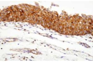 Immunohistochemistry (IHC) image for anti-Heat Shock Protein 90kDa alpha (Cytosolic), Class A Member 1 (HSP90AA1) (AA 1-732), (N-Term) antibody (ABIN317532) (HSP90AA1 antibody  (N-Term))