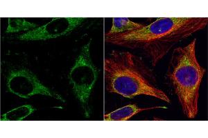 ICC/IF Image Endothelin 1 antibody [C1C3] detects Endothelin 1 protein at cytoplasm by immunofluorescent analysis. (Endothelin 1 antibody  (C-Term))