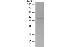 Western Blotting (WB) image for ADP-Ribosylation Factor-Like 13B (ARL13B) (AA 330-428) protein (His-IF2DI Tag) (ABIN7282066) (ARL13B Protein (AA 330-428) (His-IF2DI Tag))