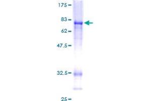 Image no. 1 for C-terminal Binding Protein 2 (CTBP2) (AA 1-445) protein (GST tag) (ABIN1350623) (CTBP2 Protein (AA 1-445) (GST tag))