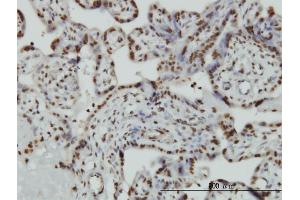 Immunoperoxidase of monoclonal antibody to HMGB2 on formalin-fixed paraffin-embedded human placenta. (HMGB2 antibody  (AA 1-195))