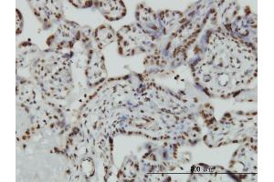 Immunoperoxidase of monoclonal antibody to HMGB2 on formalin-fixed paraffin-embedded human placenta.