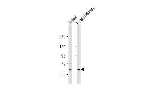 All lanes : Anti-EPHX2 Antibody (N-Term) at 1:2000 dilution Lane 1: Jurkat whole cell lysate Lane 2: human fetal kidney lysate Lysates/proteins at 20 μg per lane. (EPHX2 antibody  (AA 64-94))