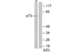 Western Blotting (WB) image for anti-Tumor Protein P73 (TP73) (Internal Region) antibody (ABIN1848960) (Tumor Protein p73 antibody  (Internal Region))