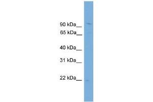 Human THP-1; WB Suggested Anti-TPPP3 Antibody Titration: 0. (TPPP3 antibody  (N-Term))