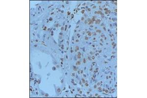 Formalin-PBS and Bouin embedded paraffin human renal tissue pretreated with heat induced epitope retrieval Citrate buffer pH 6. (GREM1 antibody  (C-Term))