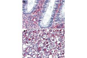 Immunohistochemical staining of formalin-fixed, paraffin-embedded human uterus (A) and human adrenal gland (B) tissue after heat-induced antigen retrieval. (Angiotensin II Type 2 Receptor antibody  (Internal Region))