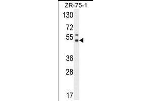 Western blot analysis in ZR-75-1 cell line lysates (35ug/lane). (PUS3 antibody  (N-Term))