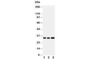 Western blot testing of Oncostatin M antibody and Lane 1:  A549