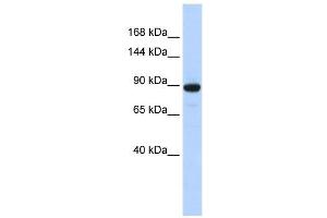 PDE3A antibody used at 1 ug/ml to detect target protein.