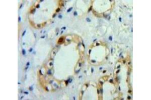 Used in DAB staining on fromalin fixed paraffin-embedded Kidney tissue (APP antibody  (AA 18-286))